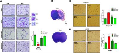 Identification of Proteins Differentially Expressed in the Striatum by Melatonin in a Middle Cerebral Artery Occlusion Rat Model—a Proteomic and in silico Approach